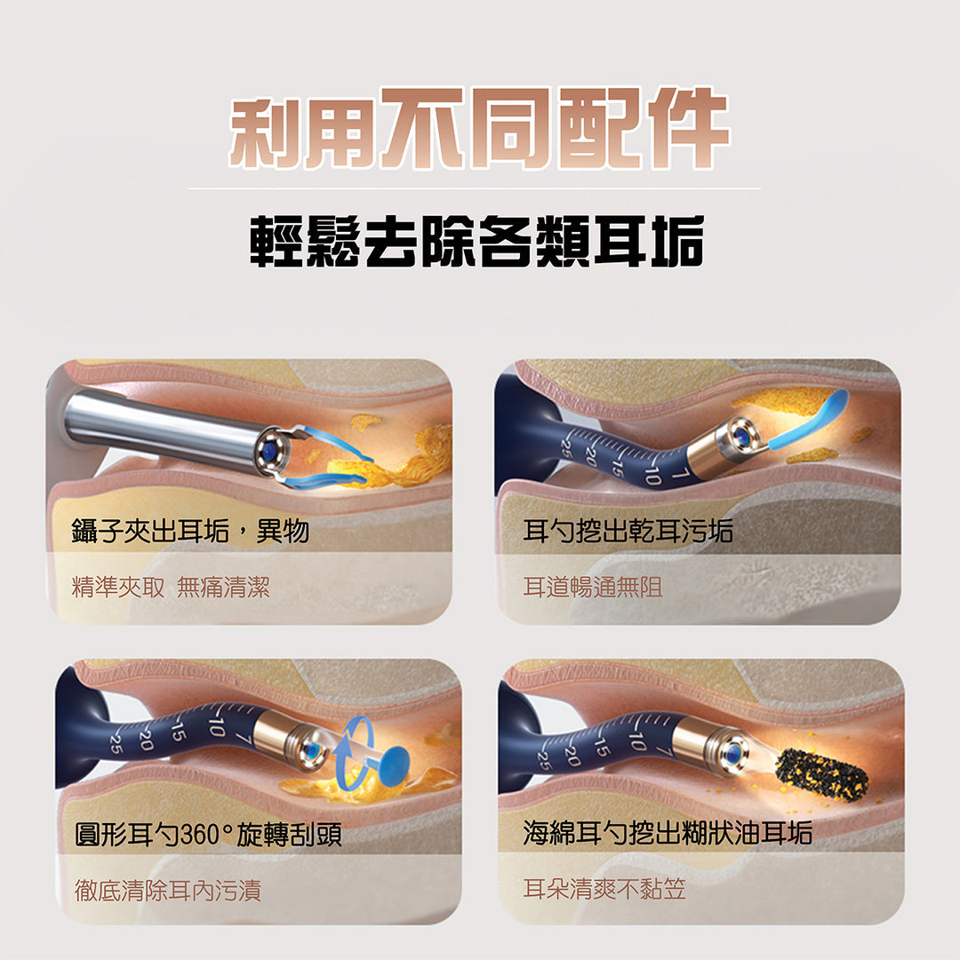 bebird earsight plus i35r 耳挖